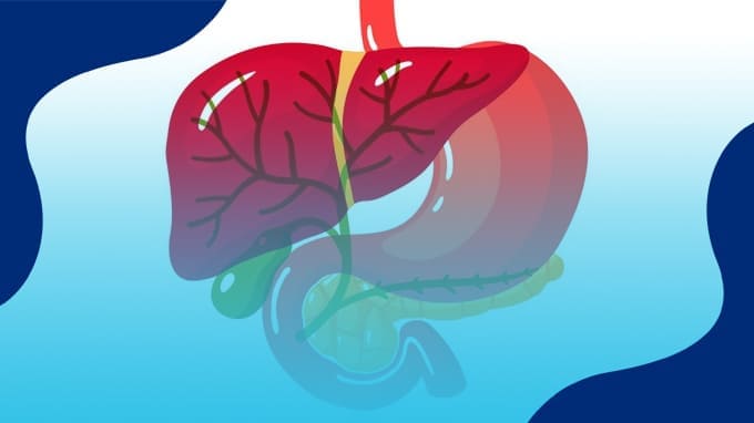 Precio Colecistectomía Laparoscópica