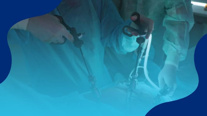 Precio Colecistectomía Laparoscópica