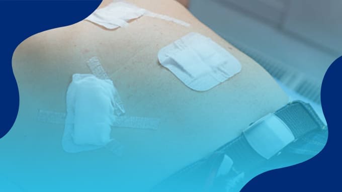 Precio Colecistectomía Laparoscópica