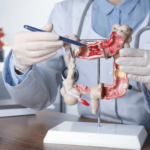 Abordaje integral del dolor abdominal crónico en la CDMX